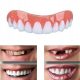  Upper and lower veneers for learning to smile