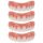  4 immediate veneers, comfortable upper jaw prostheses