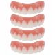  4 immediate veneers, comfortable upper jaw prostheses